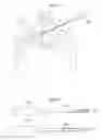 Fig. 07 - Hip joint instrument and method