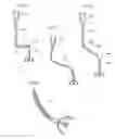 Fig. 15 - Hip joint instrument and method