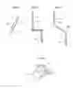 Fig. 19 - Hip joint instrument and method