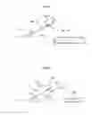 Fig. 20 - Hip joint instrument and method