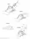 Fig. 21 - Hip joint instrument and method