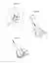 Fig. 26 - Hip joint instrument and method