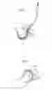 Fig. 28 - Hip joint instrument and method