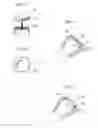 Fig. 31 - Hip joint instrument and method