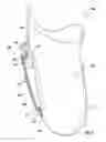 Fig. 02 - Attachment system for prosthetic device