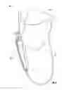 Fig. 07 - Attachment system for prosthetic device