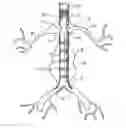 Fig. 01 - Stent with a crush-resistant zone