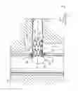 Fig. 04 - Stent with a crush-resistant zone