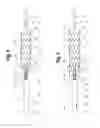 Fig. 05 - Deployment handle for a prosthesis delivery device