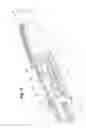 Fig. 10 - Deployment handle for a prosthesis delivery device