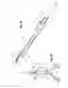 Fig. 20 - Deployment handle for a prosthesis delivery device