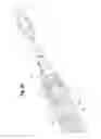 Fig. 23 - Deployment handle for a prosthesis delivery device