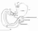 Fig. 01 - Methods Of Treatment Using A Bariatric Sleeve