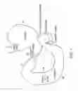 Fig. 02 - Methods Of Treatment Using A Bariatric Sleeve