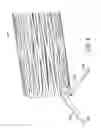 Fig. 11 - Methods Of Treatment Using A Bariatric Sleeve