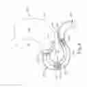 Fig. 06 - Conforming anchor for duodenal barrier