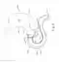 Fig. 07 - Conforming anchor for duodenal barrier