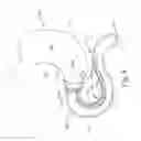 Fig. 08 - Conforming anchor for duodenal barrier