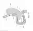 Fig. 10 - Conforming anchor for duodenal barrier