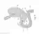 Fig. 11 - Conforming anchor for duodenal barrier