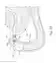 Fig. 12 - Conforming anchor for duodenal barrier