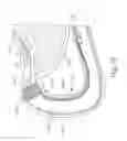 Fig. 13 - Conforming anchor for duodenal barrier
