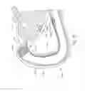 Fig. 14 - Conforming anchor for duodenal barrier