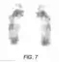 Fig. 06 - FOOT ORTHOTIC FABRICATION SYSTEM AND METHODS OF OPERATING