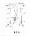 Fig. 04 - Drainable ostomy pouch