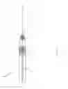 Fig. 12 - REVERSIBLE OCCLUSION DEVICE