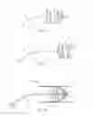 Fig. 23 - REVERSIBLE OCCLUSION DEVICE