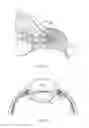 Fig. 02 - Delivery system for ocular implant