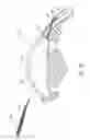 Fig. 12 - Intraocular shunt delivery