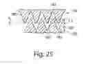 Fig. 21 - ABSORBENT ARTICLES COMPRISING GARMENT-FACING LAMINATES