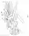 Fig. 12 - Leg assembly for height adjustable patient support