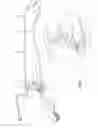 Fig. 02 - Infant Soothing Device