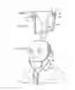 Fig. 12 - ORAL MOUTHPIECE AND METHOD FOR THE USE THEREOF