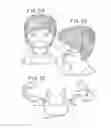 Fig. 15 - ORAL MOUTHPIECE AND METHOD FOR THE USE THEREOF