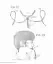 Fig. 16 - ORAL MOUTHPIECE AND METHOD FOR THE USE THEREOF