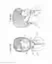 Fig. 17 - ORAL MOUTHPIECE AND METHOD FOR THE USE THEREOF