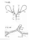 Fig. 20 - ORAL MOUTHPIECE AND METHOD FOR THE USE THEREOF