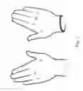 Fig. 02 - Guiding means for administering acupuncture and other healing procedures