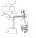 Fig. 01 - SYSTEM AND APPARATUS FOR CONTROLLING FOOD INTAKE