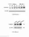 Fig. 10 - A3 adenosine receptor ligands for modulation of pigmentation