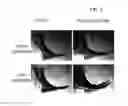 Fig. 03 - Cosmetic Compositions Having Persistent Tightening Effects