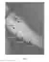 Fig. 02 - Compositions and methods for the treatment of a common cold and symptoms thereof