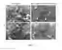 Fig. 10 - Use of cilastatin to reduce the nephrotoxicity of different compounds
