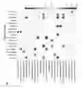 Fig. 04 - Methods for treating psoriatic arthritis