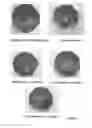 Fig. 12 - Pharmaceutical compositions of Anisomelic acid and the use thereof