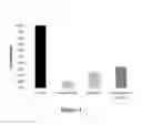 Fig. 02 - Compositions for treating amyotrophic lateral sclerosis